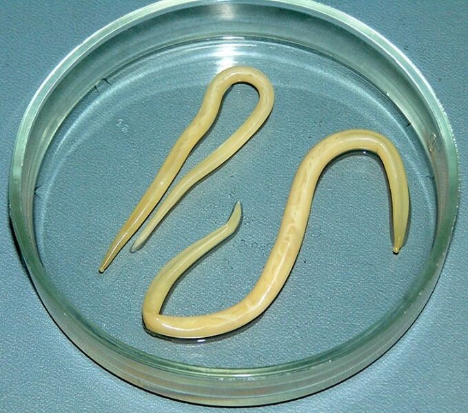 červ parazit z lidského těla