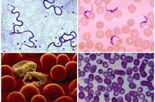 jaké parazity mohou být v lidské krvi